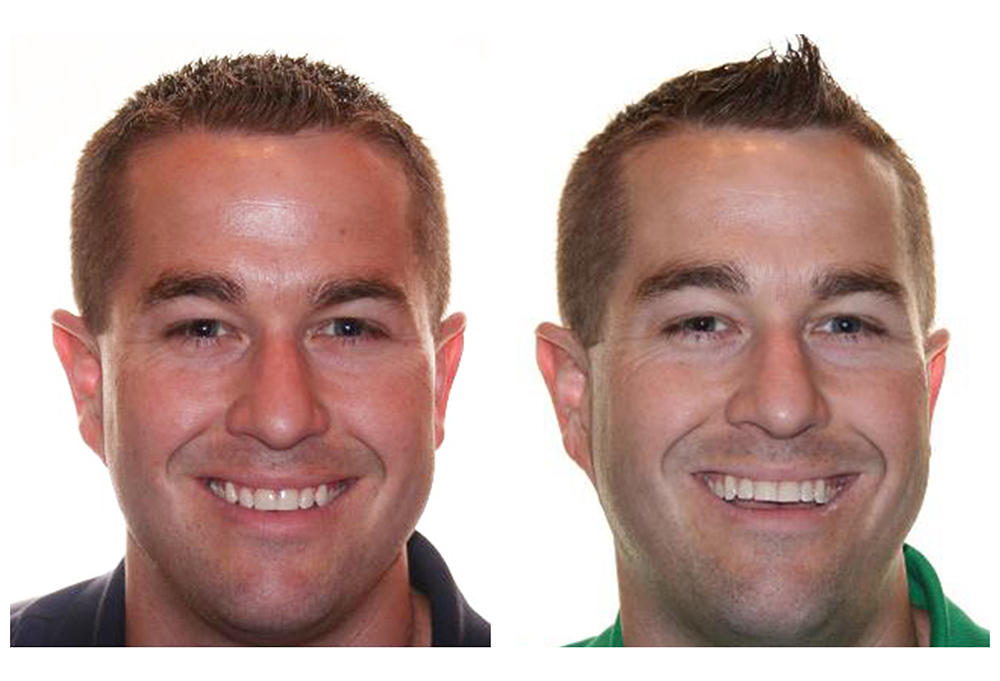 Royersford Dental Health