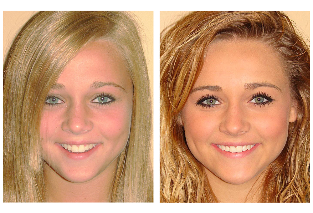 Royersford Dental Health